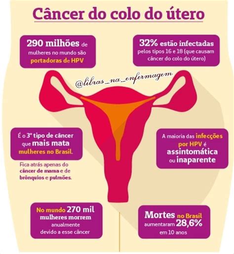 cancer de colo de utero - liso de dalia